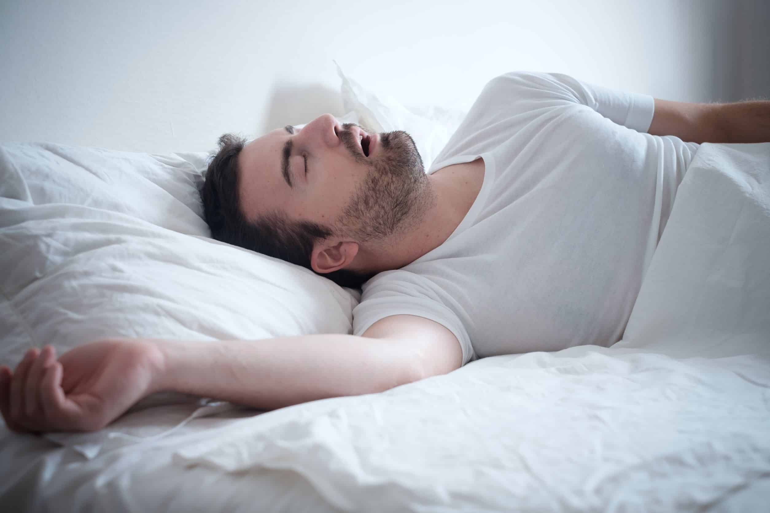 Sleep apnea